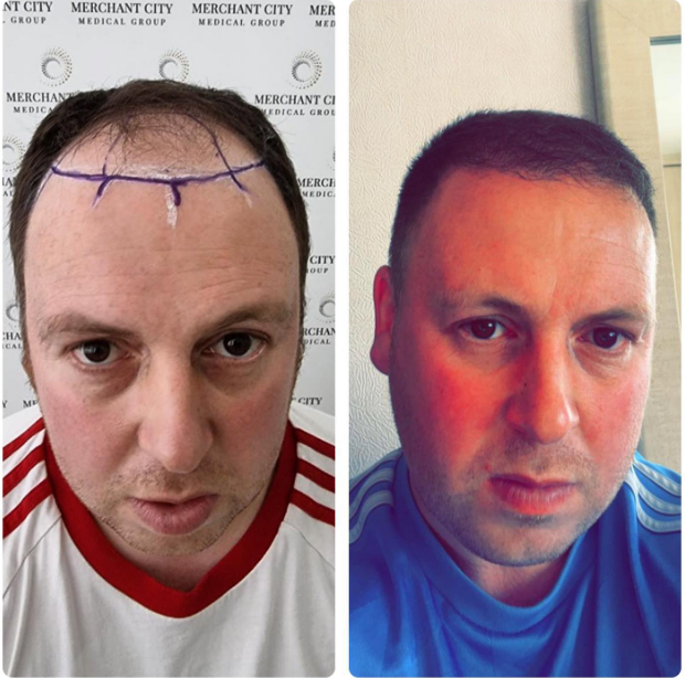 Before and after for a former patient