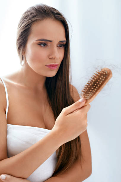 Hair Loss. Upset Woman Holding Brush With Hair, Hair Falling Out. High Resolution