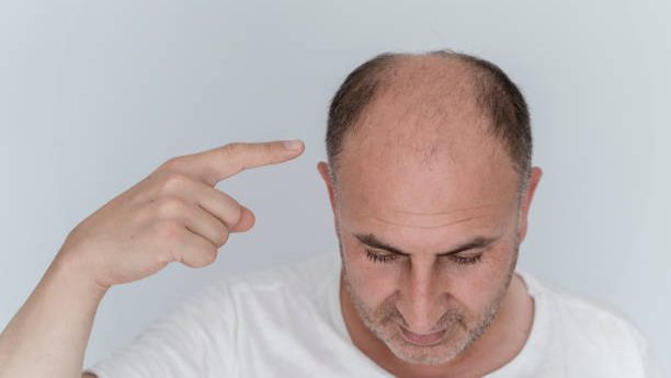 Bald young man looking up, studio shot