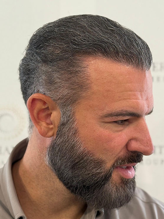 Scott 4