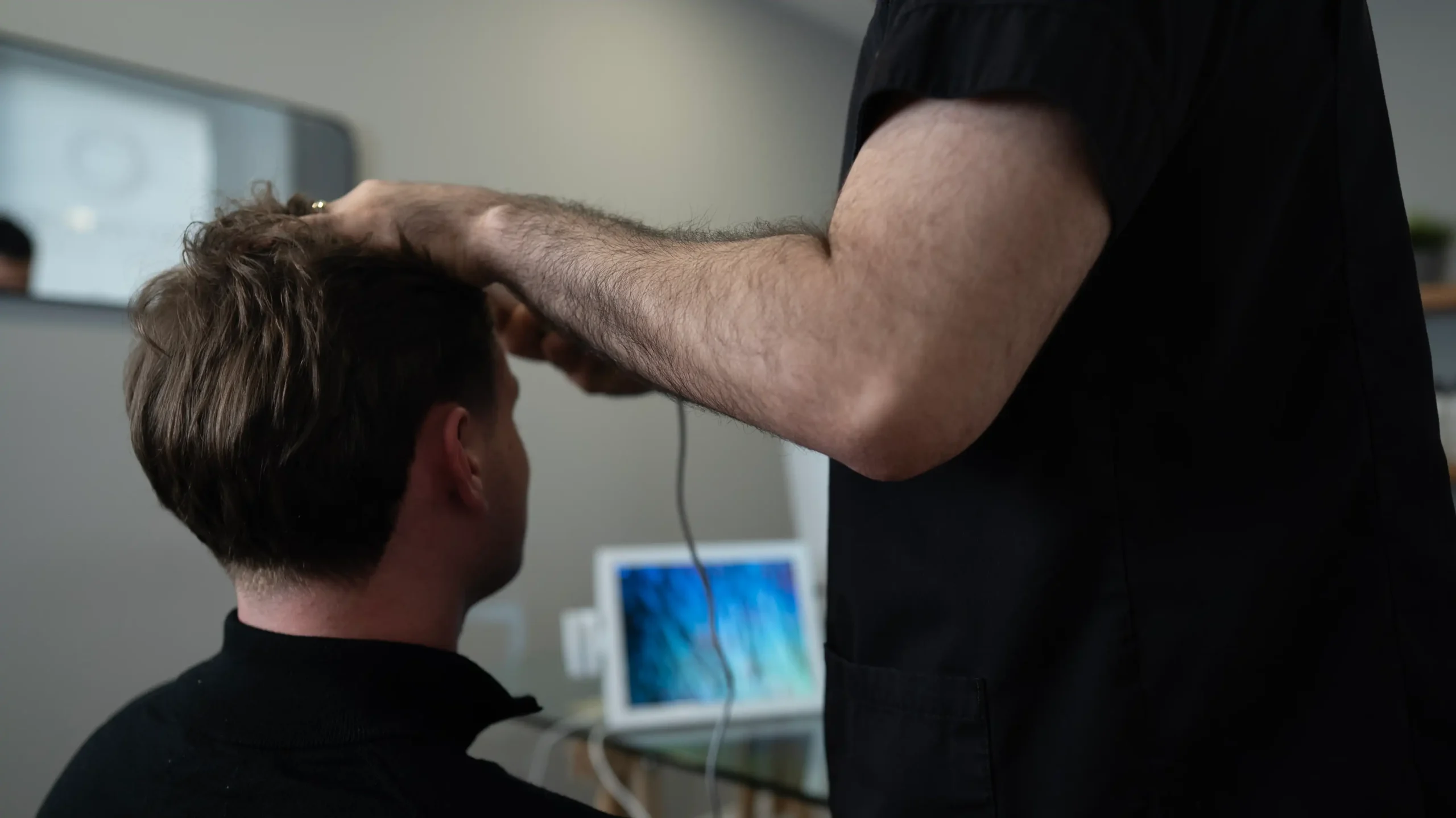 hair transplant procedure