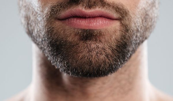 Beard-Transplant-001