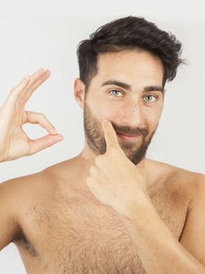 beard-transplant-00
